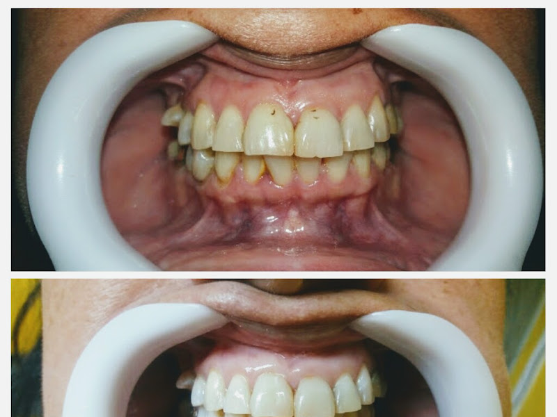 Foto 8 de Clínica Arte de Sorrir - Implantes dentários em Nova Iguaçu | Odontopediatria em Nova Iguaçu