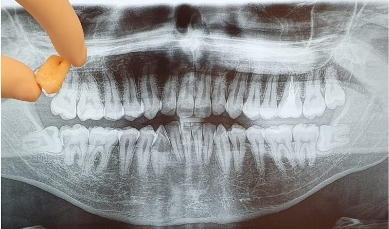 Foto 3 de Clinica Arte Ortho. Ortodontia, Disfunções ATM, Lentes, Odontologia Estética.