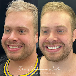 Foto 2 de Clínica Ávila - Harmonização Facial - Odontologia - Prótese Dentária - Asa Sul - Brasília - DF