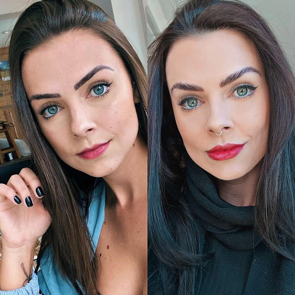 Foto 3 de Clínica Aysú - Dra Maikiara N. Ballera