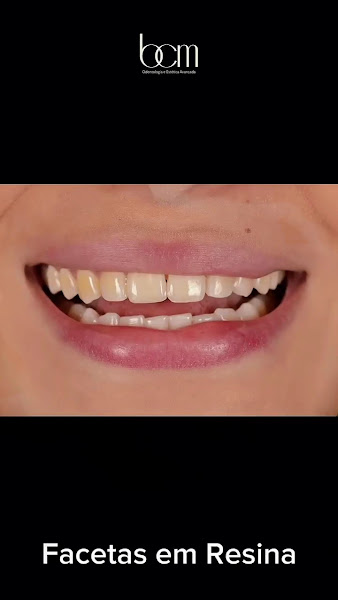 Foto 4 de Clinica BCM Odontologia e Estética Avançada