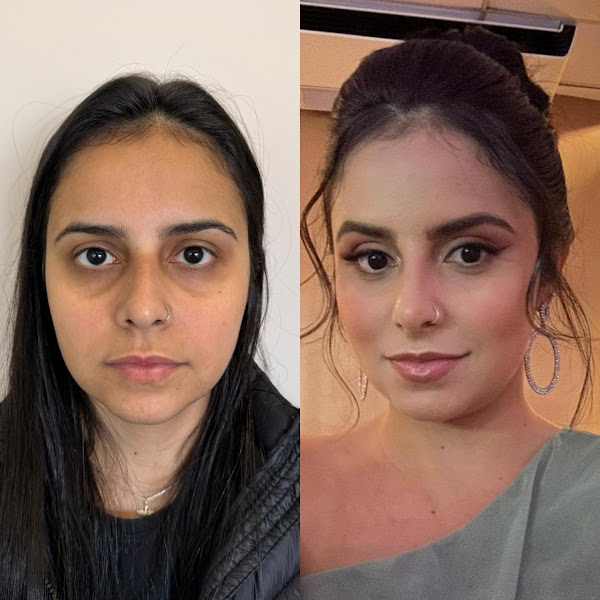 Foto 2 de Clínica Beeautify | Harmonização Facial e Estética | São Caetano e ABC