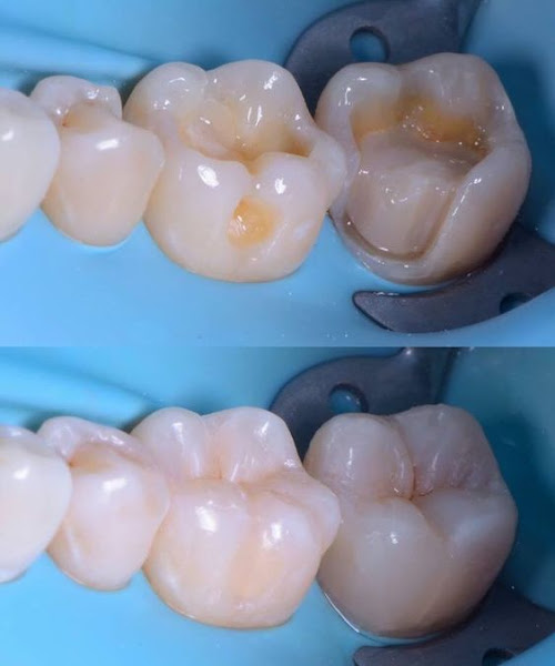 Foto 3 de Clínica Big Odonto Novo Hamburgo Dentista-Aparelho-Implante-Prótese