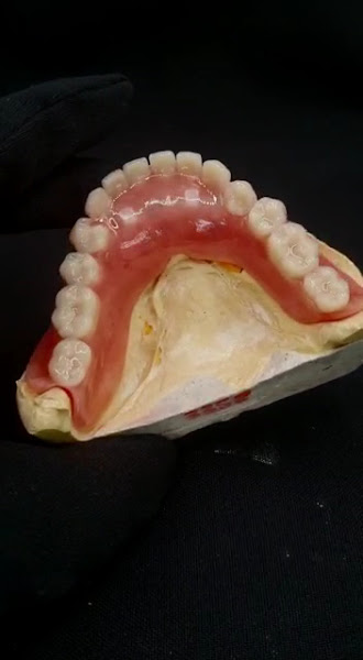 Foto 4 de Clínica Big Odonto Novo Hamburgo Dentista-Aparelho-Implante-Prótese