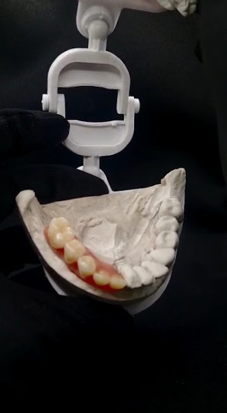 Foto 5 de Clínica Big Odonto Novo Hamburgo Dentista-Aparelho-Implante-Prótese