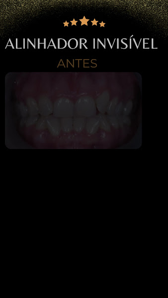 Foto 3 de Clínica Bio Odonto | Implante Dentário | Invisalign | Pituba | Salvador - BA