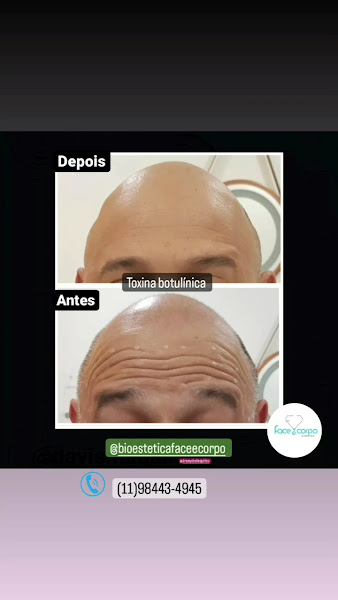 Foto 3 de Clinica bioestetica face e corpo Estetica e Beleza