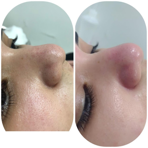 Foto 3 de Clínica Blu Estética Avançada e Saúde