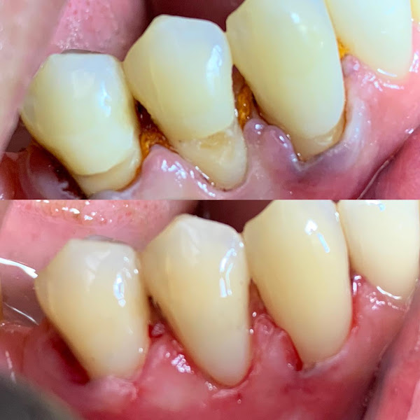 Foto 2 de Clínica Boulevard