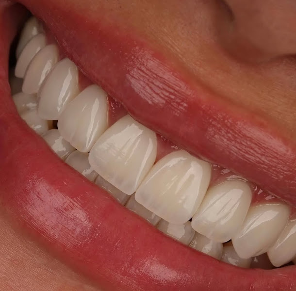 Foto 3 de Clínica Boutique Dra. Fabiana Dantas | Implantes Dentários em Teresina | Lentes de Contato Dental | Harmonização Facial