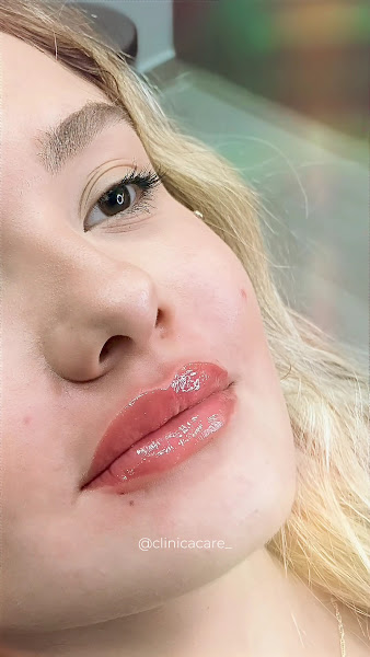 Foto 3 de Clínica CARE Harmonização Facial em Barbacena