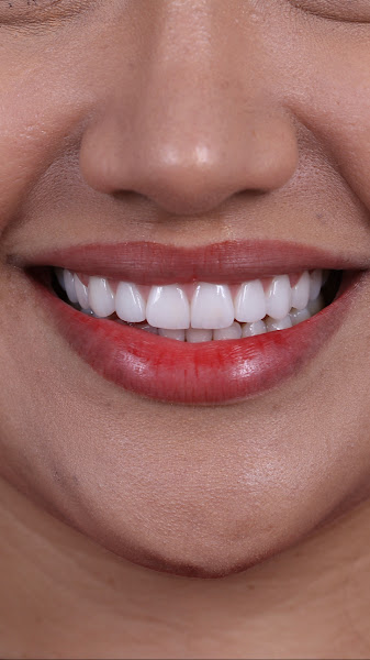 Foto 2 de Clínica CENII Centro Integrado de Implantodontia