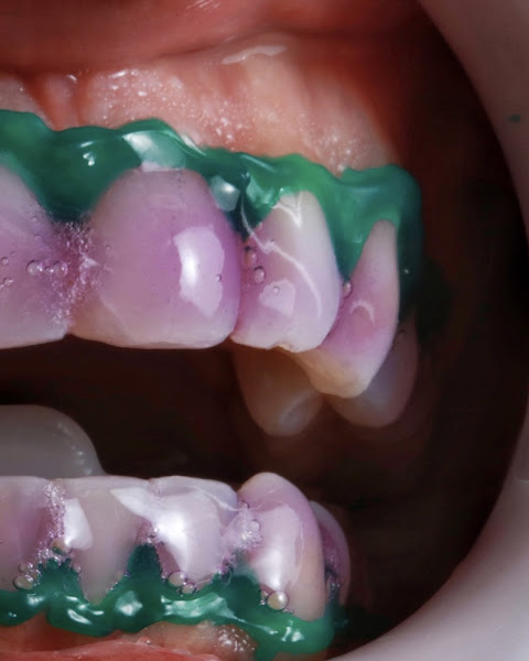 Foto 3 de Clínica Central do Sorriso - Dentista Particular Feira de Santana