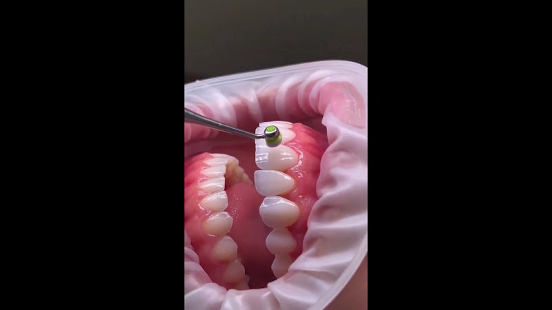 Foto 4 de Clínica Central do Sorriso - Dentista Particular Feira de Santana