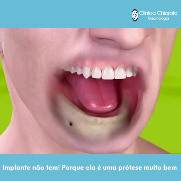 Foto 2 de Clínica Chiorato Odontologia | Implantes | Lentes | Invisalign