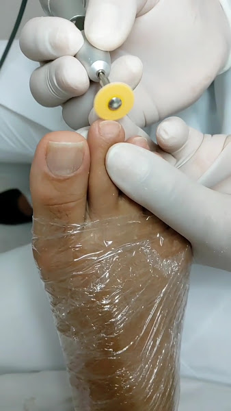 Foto 3 de Clínica Cida Simões - Podologia Avançada, Massoterapia Premium e Harmonização Facial & Corporal Premium