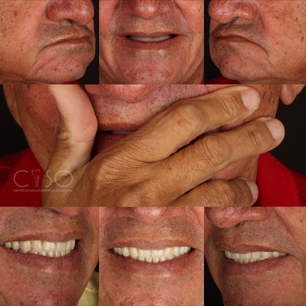 Foto 3 de Clínica CISO - Centro de Implantodontia e Saúde Oral