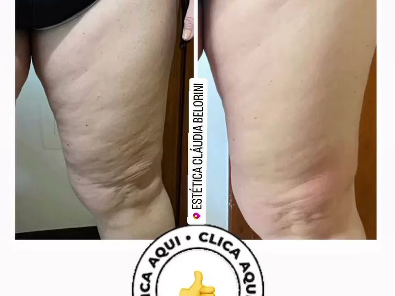 Foto 3 de Clínica Cláudia Belorini - Harmonização e Estética