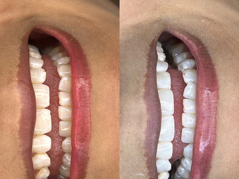 Foto 5 de Clinica Competence- Dra. Erenilse Lemos De Freitas