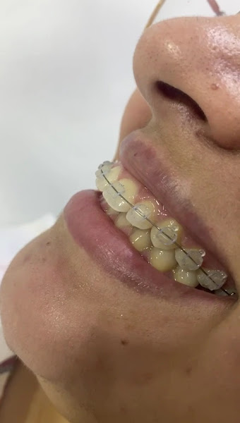 Foto 4 de Clínica Cortez - cortez odontologia