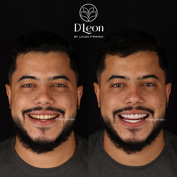 Foto 3 de Clínica D’Leon Balneário Camboriú