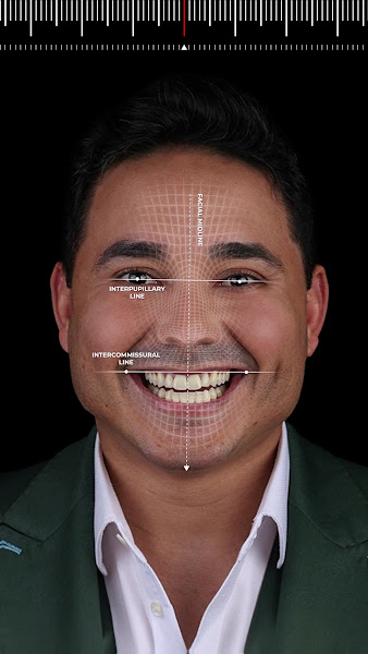 Foto 3 de Clínica D’Leon by Lucas Firmino | Lentes de pocelana e Implantes