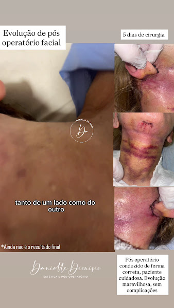 Foto 2 de Clinica Danielle Dionisio Estética/Pós operatório Arapiraca