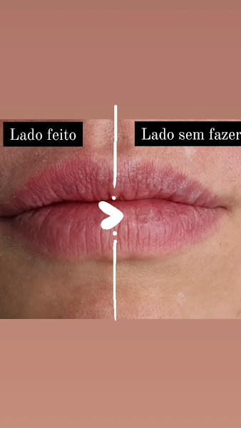 Foto 3 de Clinica de Estética Avançada Morgana Toniasso