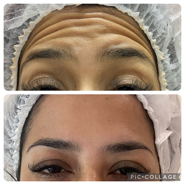 Foto 2 de Clínica de Estética Avançada São Caetano do Sul | Endolaser Rejuvenescimento Harmonização | Dra. Luciana Leomil