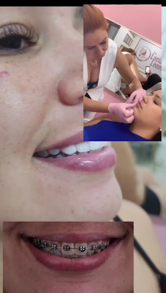 Foto 3 de Clínica de Estética Avançada São Caetano do Sul | Endolaser Rejuvenescimento Harmonização | Dra. Luciana Leomil