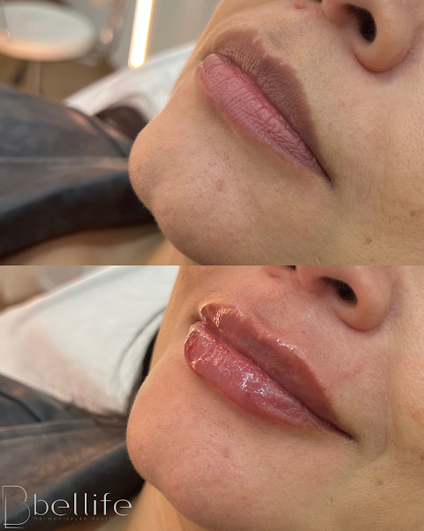 Foto 3 de Clinica de Estética Bellife Maringá