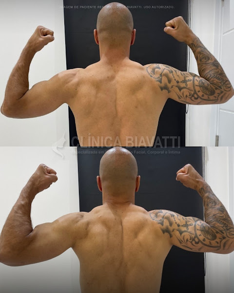 Foto 2 de Clínica de Estética Biavatti Araucária - Botox, Preenchimento, e Bioestimulador de Colágeno