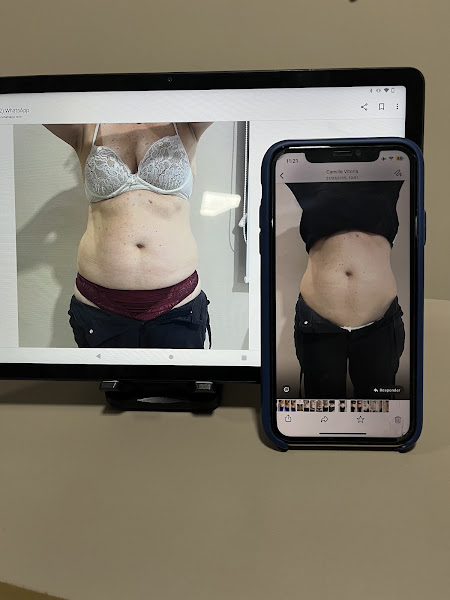 Foto 2 de Clinica de Estética- Camille Vitória Beauty