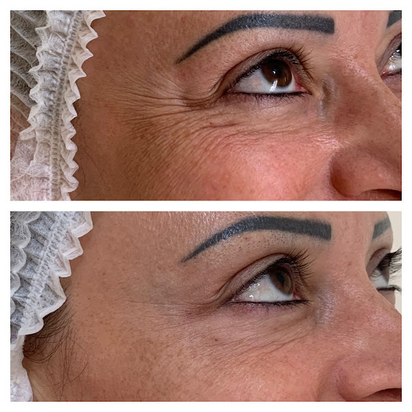 Foto 3 de Clínica de Estética Cristiane Galter