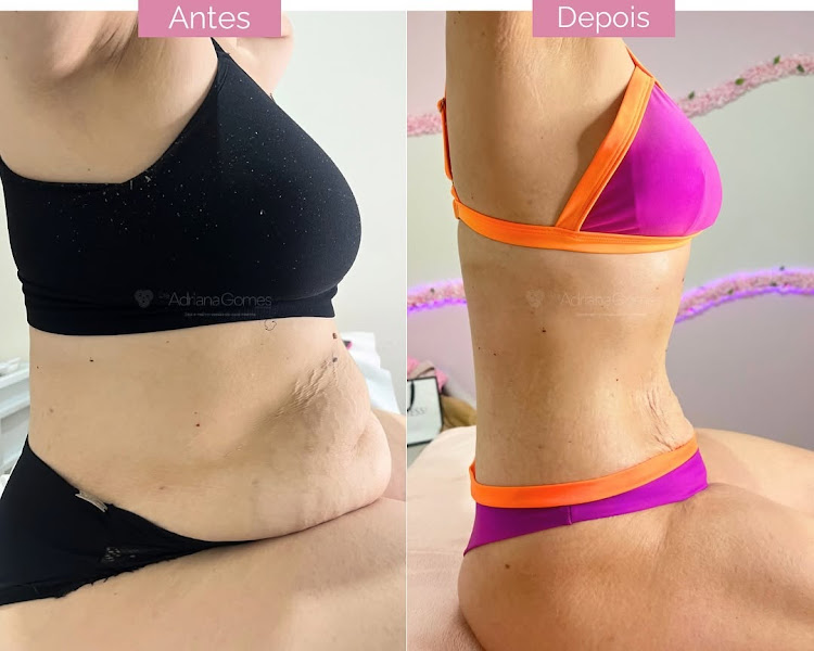 Foto 2 de Clínica de Estética Dra. Adriana Gomes | Criomodelagem | Detox | Pós-parto | Botox | Toledo - PR