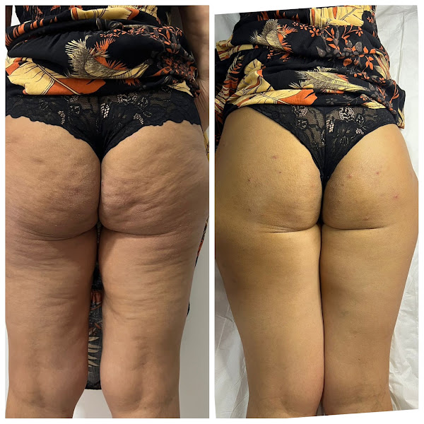 Foto de Clinica de estética Dra Andreia Borges Hortolândia