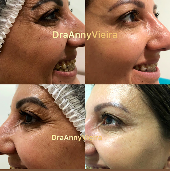 Foto 3 de Clinica de Estética Dra Anny Vieira