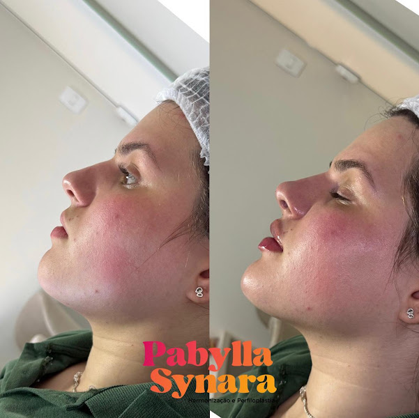 Foto 3 de Clínica de Estética Dra. Pabylla Synara