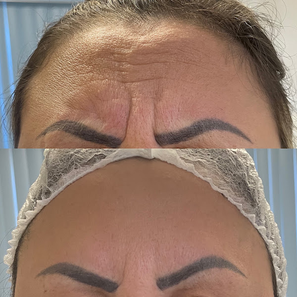 Foto 2 de Clínica de Estética Dra. Paola Ferreira / Botox / Preenchimento / Harmonização / Manchas / Rinomodelação / Lavieen