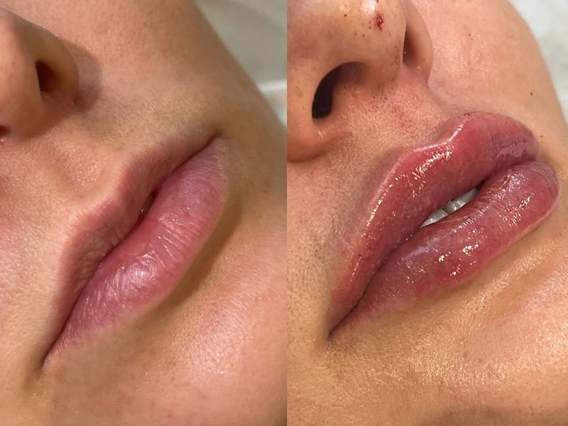 Foto de Clínica de Estética e Harmonização em Bauru: Dra.Carol Haneda