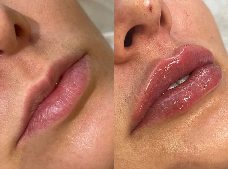 Foto 2 de Clínica de Estética e Harmonização em Bauru: Dra.Carol Haneda