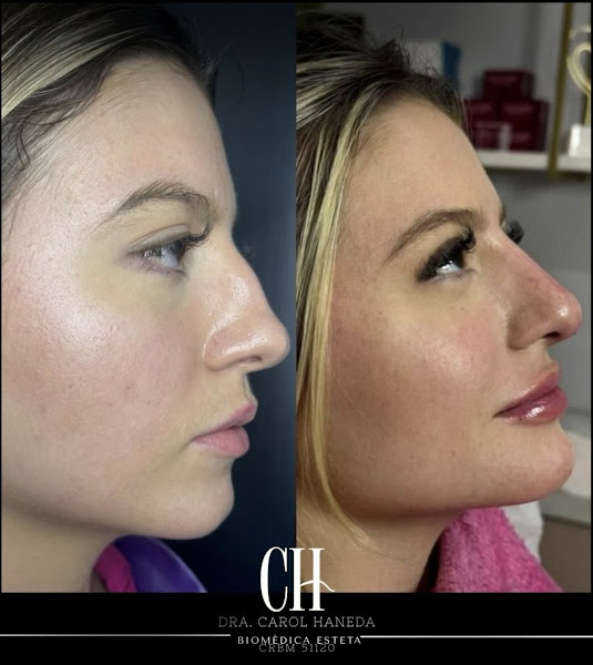 Foto 3 de Clínica de Estética e Harmonização em Bauru: Dra.Carol Haneda