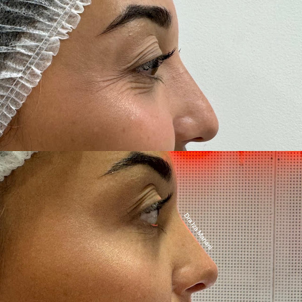 Foto 3 de Clínica de Estética em Vila Velha | Instituto Harmonic | Harmonização Facial