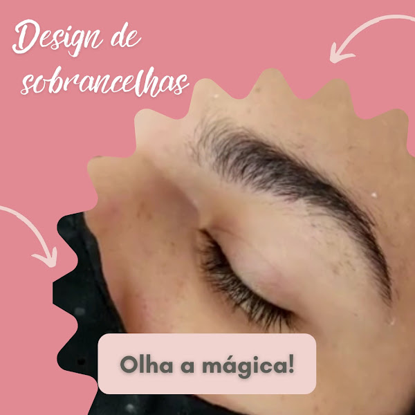 Foto 2 de Clínica de Estética | Fotodepilação | Limpeza de Pele | Radiofrequência | Luana Munhoz - São Caetano do Sul - SP