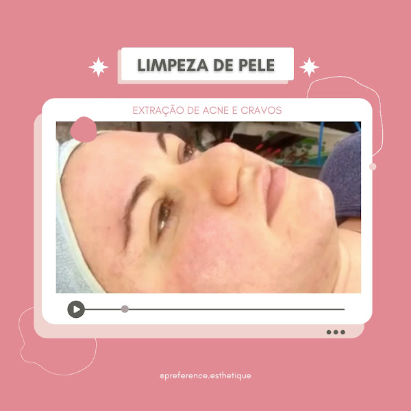 Foto 3 de Clínica de Estética | Fotodepilação | Limpeza de Pele | Radiofrequência | Luana Munhoz - São Caetano do Sul - SP