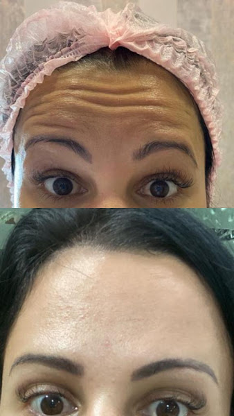 Foto 3 de Clínica de Estética Ingrid Monteiro Harmonização Facial