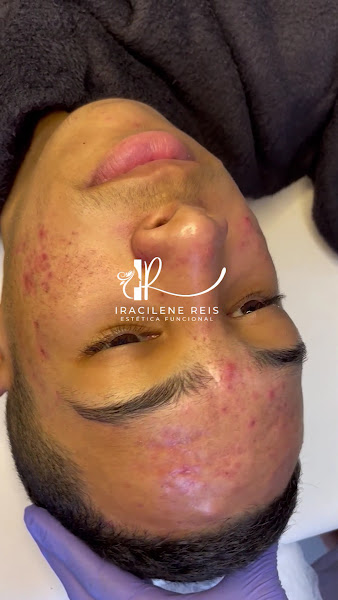Foto 2 de Clínica de Estética Iracilene Reis no Valparaíso