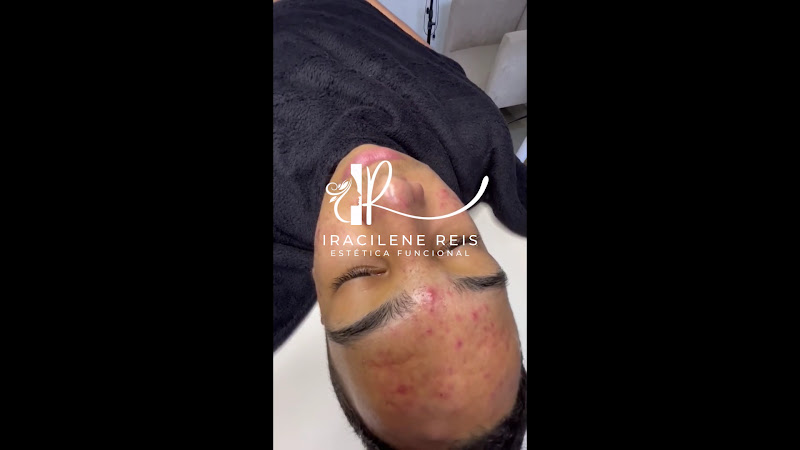 Foto 3 de Clínica de Estética Iracilene Reis no Valparaíso