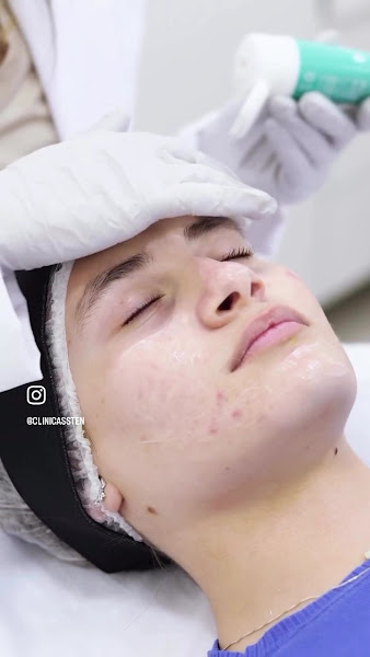 Foto 3 de Clínica de Estética Ssten - Estética e Saúde Integrativa - Barra da Tijuca - Harmonização Facial e Corporal
