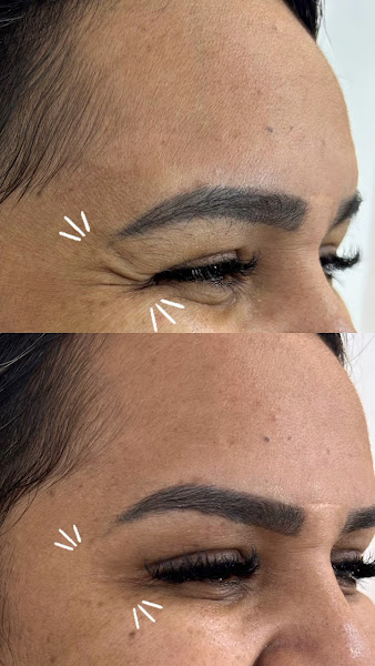 Foto 3 de Clínica de Estética Vicente Pires Elevare